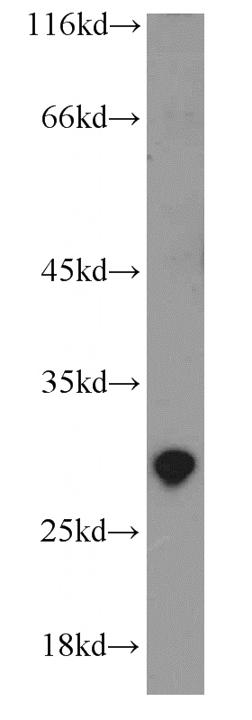 K-562 cells were subjected to SDS PAGE followed by western blot with Catalog No:110412(EXOSC5 antibody) at dilution of 1:500