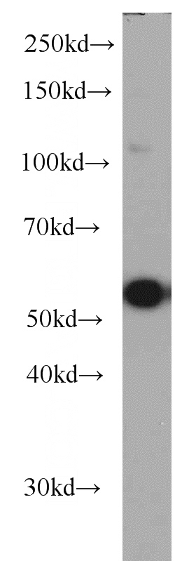 PC-3 cells were subjected to SDS PAGE followed by western blot with Catalog No:116380(TTC31 antibody) at dilution of 1:1000