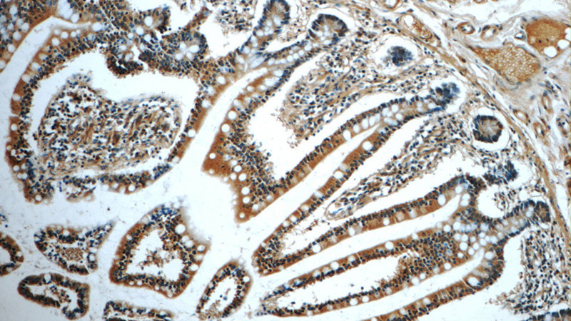 Immunohistochemistry of paraffin-embedded human small intestine tissue slide using Catalog No:112538(MGAT4A Antibody) at dilution of 1:50 (under 10x lens)
