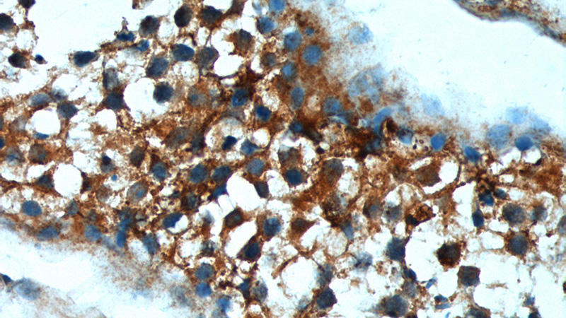 Immunohistochemistry of paraffin-embedded human testis tissue slide using Catalog No:116300(TRIM16 Antibody) at dilution of 1:200 (under 40x lens).