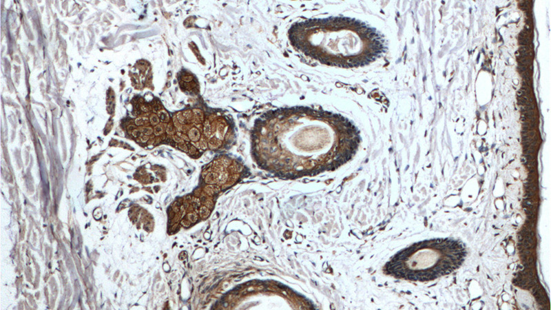Immunohistochemistry of paraffin-embedded human skin tissue slide using (CD1D Antibody) at dilution of 1:100 (under 10x lens).