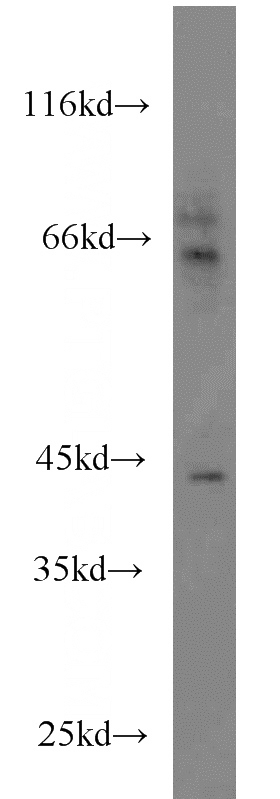 PC-3 cells were subjected to SDS PAGE followed by western blot with Catalog No:117058(AZGP1 antibody) at dilution of 1:500