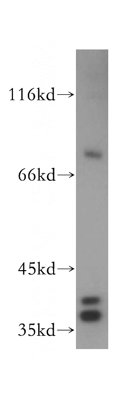 Jurkat cells were subjected to SDS PAGE followed by western blot with Catalog No:115823(SUGT1 antibody) at dilution of 1:300