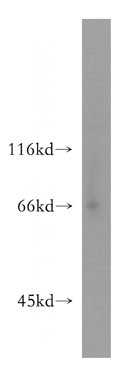 human brain tissue were subjected to SDS PAGE followed by western blot with Catalog No:112343(LSAMP antibody) at dilution of 1:300