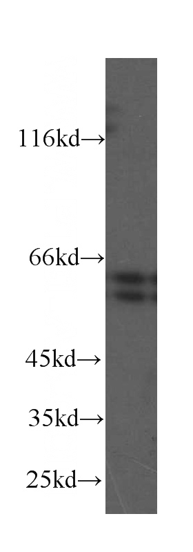 HeLa cells were subjected to SDS PAGE followed by western blot with Catalog No:107567(AKT antibody) at dilution of 1:1000