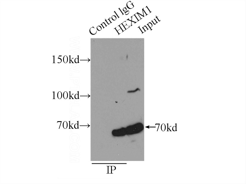 IP Result of anti-HEXIM1 (IP:Catalog No:111304, 4ug; Detection:Catalog No:111304 1:500) with MCF-7 cells lysate 2000ug.