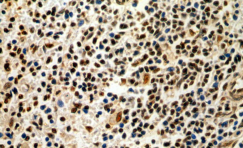 Immunohistochemical of paraffin-embedded human spleen using Catalog No:111650(IKZF3 antibody) at dilution of 1:100 (under 40x lens)