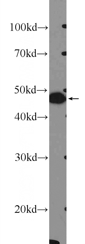 mouse ovary tissue were subjected to SDS PAGE followed by western blot with Catalog No:110701(FOXL2-Specific Antibody) at dilution of 1:300