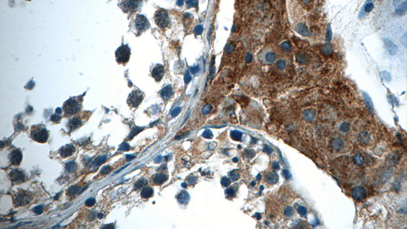 Immunohistochemistry of paraffin-embedded human testis tissue slide using Catalog No:108610(C16orf84 Antibody) at dilution of 1:50 (under 40x lens)