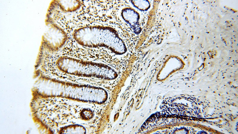 Immunohistochemical of paraffin-embedded human colon using Catalog No:116812(WDR55 antibody) at dilution of 1:50 (under 10x lens)