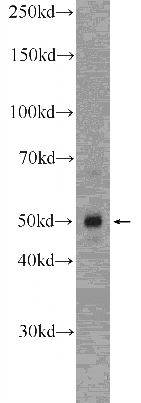 A431 cells were subjected to SDS PAGE followed by western blot with Catalog No:108671(C1orf156 Antibody) at dilution of 1:300