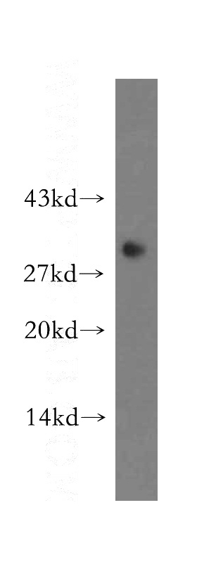 HeLa cells were subjected to SDS PAGE followed by western blot with Catalog No:108940(CBR3 antibody) at dilution of 1:500