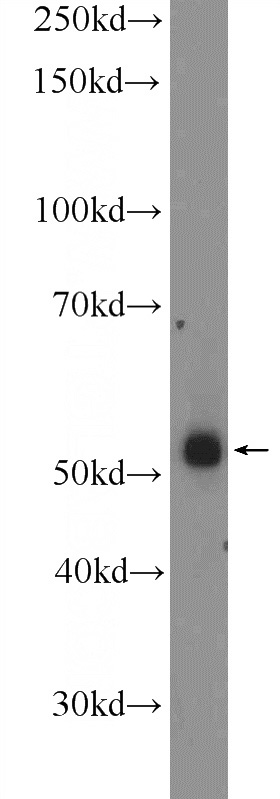 mouse testis tissue were subjected to SDS PAGE followed by western blot with Catalog No:116967(ZNF256 Antibody) at dilution of 1:300