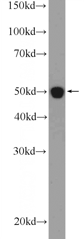 MDCK cells were subjected to SDS PAGE followed by western blot with Catalog No:111669(IFT52 Antibody) at dilution of 1:600