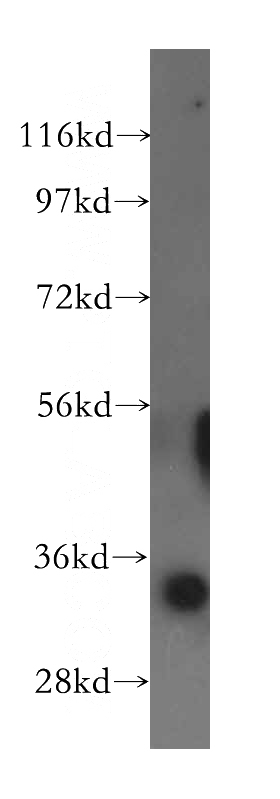 mouse brain tissue were subjected to SDS PAGE followed by western blot with Catalog No:111029(GLOD4 antibody) at dilution of 1:500