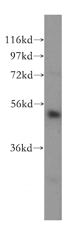 mouse skin tissue were subjected to SDS PAGE followed by western blot with Catalog No:108932(CAP1 antibody) at dilution of 1:500