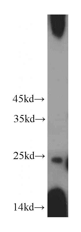 mouse pancreas tissue were subjected to SDS PAGE followed by western blot with Catalog No:115029(SDF2L1 antibody) at dilution of 1:500