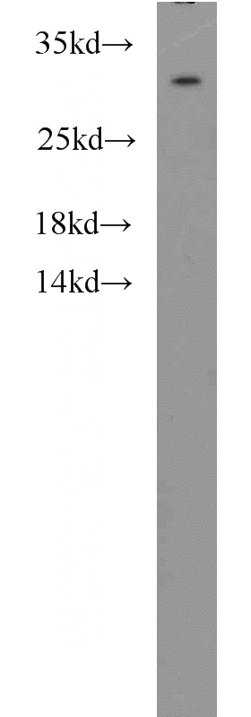 HepG2 cells were subjected to SDS PAGE followed by western blot with Catalog No:112594(MED8 antibody) at dilution of 1:1000