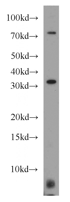 Jurkat cells were subjected to SDS PAGE followed by western blot with Catalog No:112592(MED4 antibody) at dilution of 1:600