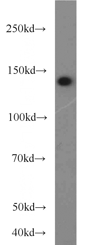 HepG2 cells were subjected to SDS PAGE followed by western blot with Catalog No:112666(MKL1 antibody) at dilution of 1:3000