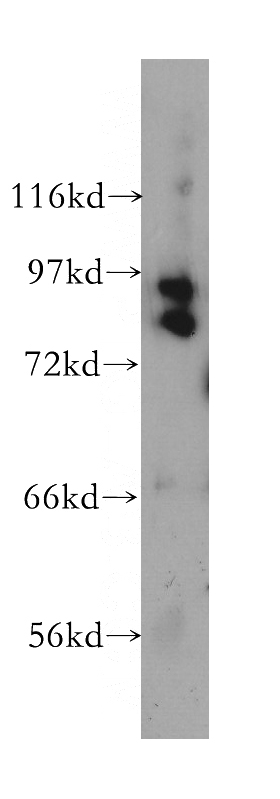 BxPC-3 cells were subjected to SDS PAGE followed by western blot with Catalog No:109741(CUL1 antibody) at dilution of 1:400