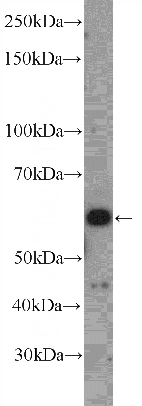 HepG2 cells were subjected to SDS PAGE followed by western blot with Catalog No:112219(LHX6 Antibody) at dilution of 1:300