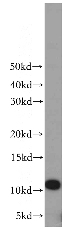 HeLa cells were subjected to SDS PAGE followed by western blot with Catalog No:112350(LSM5 antibody) at dilution of 1:100