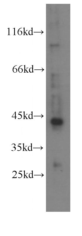 HeLa cells were subjected to SDS PAGE followed by western blot with Catalog No:107514(RXRA antibody) at dilution of 1:100