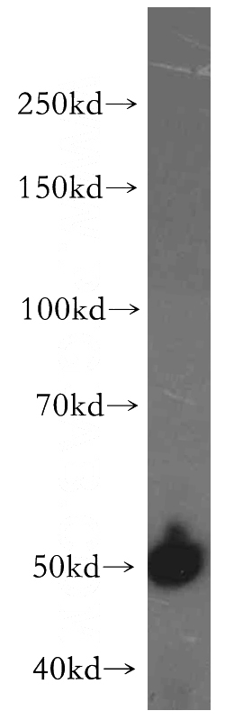 COLO 320 cells were subjected to SDS PAGE followed by western blot with Catalog No:109697(CYP2S1 antibody) at dilution of 1:500