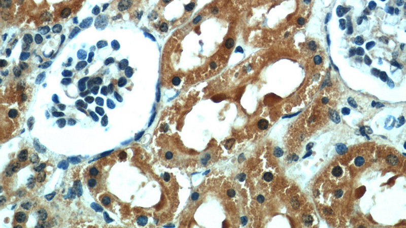 Immunohistochemical of paraffin-embedded human kidney using Catalog No:114467(RPTOR antibody) at dilution of 1:50 (under 40x lens)