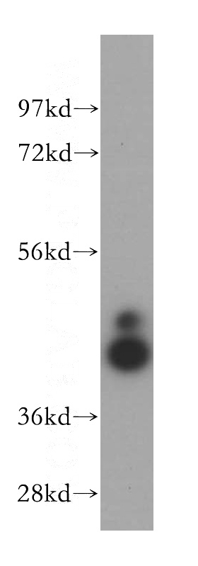 mouse brain tissue were subjected to SDS PAGE followed by western blot with Catalog No:113036(NCK1 antibody) at dilution of 1:400