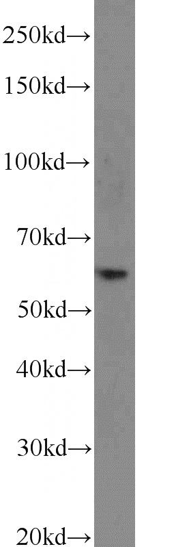 mouse lung tissue were subjected to SDS PAGE followed by western blot with Catalog No:109169(CDKAL1 antibody) at dilution of 1:2000