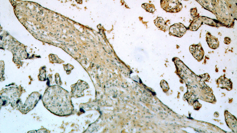 Immunohistochemical of paraffin-embedded human placenta using Catalog No:110395(EPS8L2 antibody) at dilution of 1:100 (under 10x lens)