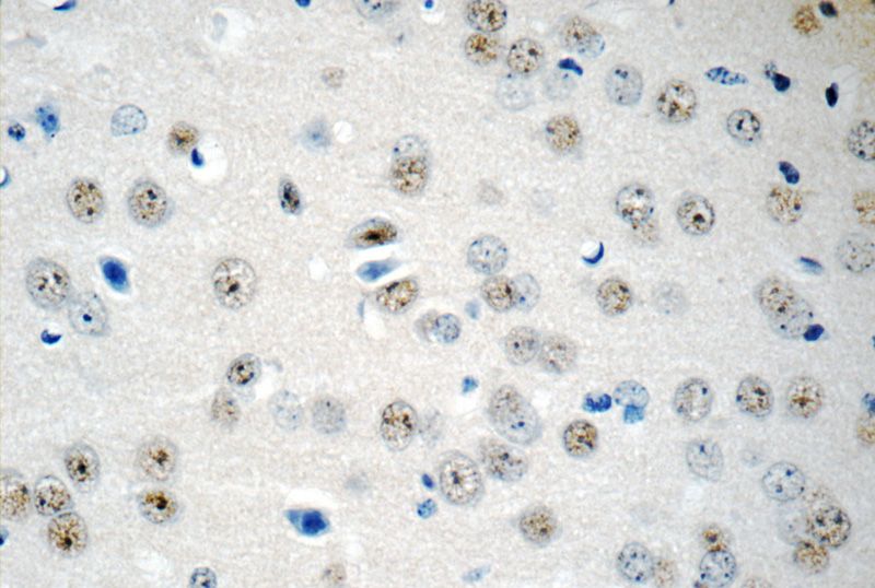 Immunohistochemistry of paraffin-embedded mouse brain tissue slide using Catalog No:114937(RUNX1T1 Antibody) at dilution of 1:50 (under 40x lens)