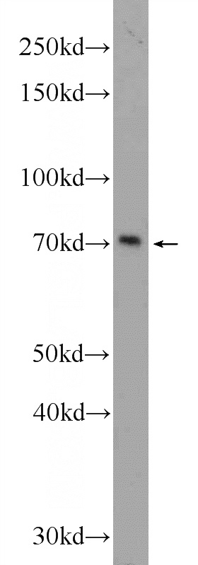 Jurkat cells were subjected to SDS PAGE followed by western blot with Catalog No:111342(HIC1 Antibody) at dilution of 1:1000