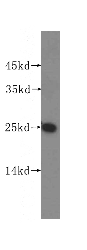 HeLa cells were subjected to SDS PAGE followed by western blot with Catalog No:109343(CLDN9-specific antibody) at dilution of 1:100