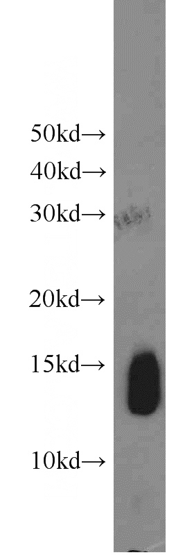 human heart tissue were subjected to SDS PAGE followed by western blot with Catalog No:111266(HBB antibody) at dilution of 1:2000