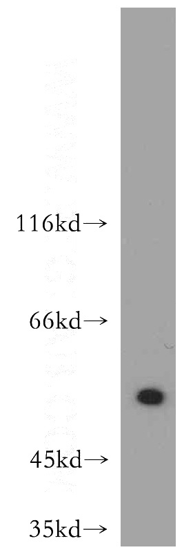 A431 cells were subjected to SDS PAGE followed by western blot with Catalog No:108285(ATF4 antibody) at dilution of 1:500