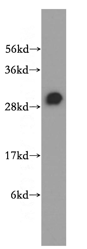 mouse heart tissue were subjected to SDS PAGE followed by western blot with Catalog No:114567(RBPMS antibody) at dilution of 1:400