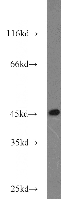 Jurkat cells were subjected to SDS PAGE followed by western blot with Catalog No:115878(TBP antibody) at dilution of 1:1000