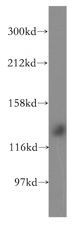 HEK-293 cells were subjected to SDS PAGE followed by western blot with Catalog No:115189(SH3BP4 antibody) at dilution of 1:300