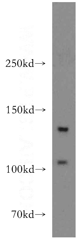 A549 cells were subjected to SDS PAGE followed by western blot with Catalog No:116024(TGFBR3-Specific antibody) at dilution of 1:300