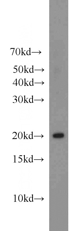 mouse brain tissue were subjected to SDS PAGE followed by western blot with Catalog No:112740(BRP44-Specific antibody) at dilution of 1:1000