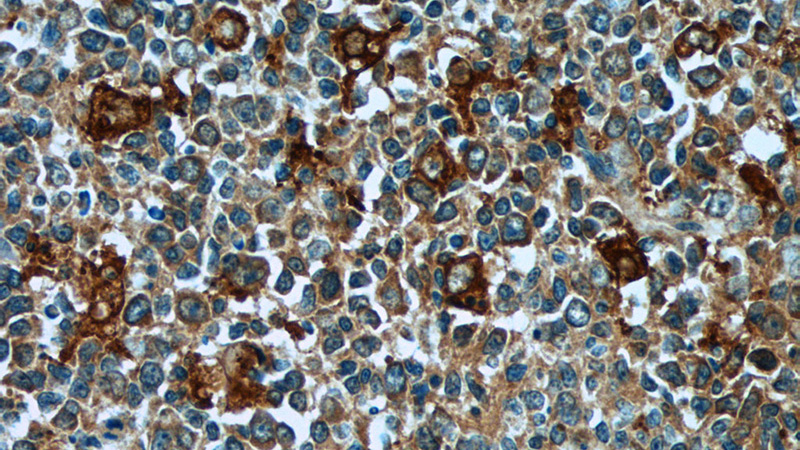 Immunohistochemistry of paraffin-embedded human tonsillitis tissue slide using Catalog No:109183(CEP63 Antibody) at dilution of 1:50 (under 40x lens)