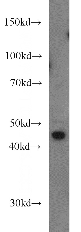 HeLa cells were subjected to SDS PAGE followed by western blot with Catalog No:114019(PM20D2 antibody) at dilution of 1:1000