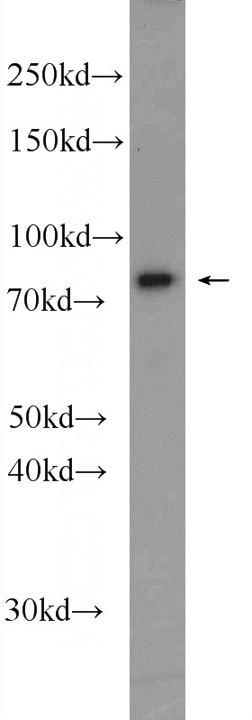 HeLa cells were subjected to SDS PAGE followed by western blot with Catalog No:113367(NUFIP2 Antibody) at dilution of 1:600