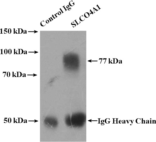IP Result of anti-SLCO4A1 (IP:Catalog No:115352, 4ug; Detection:Catalog No:115352 1:500) with L02 cells lysate 1800ug.