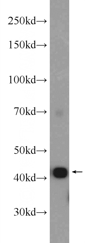 rat skeletal muscle tissue were subjected to SDS PAGE followed by western blot with Catalog No:107862(ACTA1 Antibody) at dilution of 1:4000