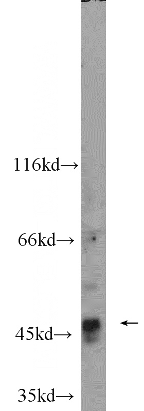 MCF7 cells were subjected to SDS PAGE followed by western blot with Catalog No:117194(BMP10 antibody) at dilution of 1:600
