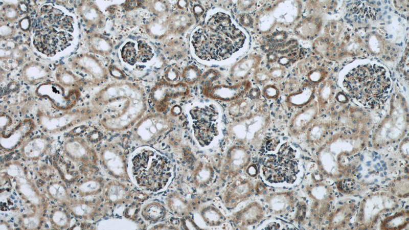 Immunohistochemical of paraffin-embedded human kidney using Catalog No:112821(MRPL28 antibody) at dilution of 1:50 (under 10x lens)